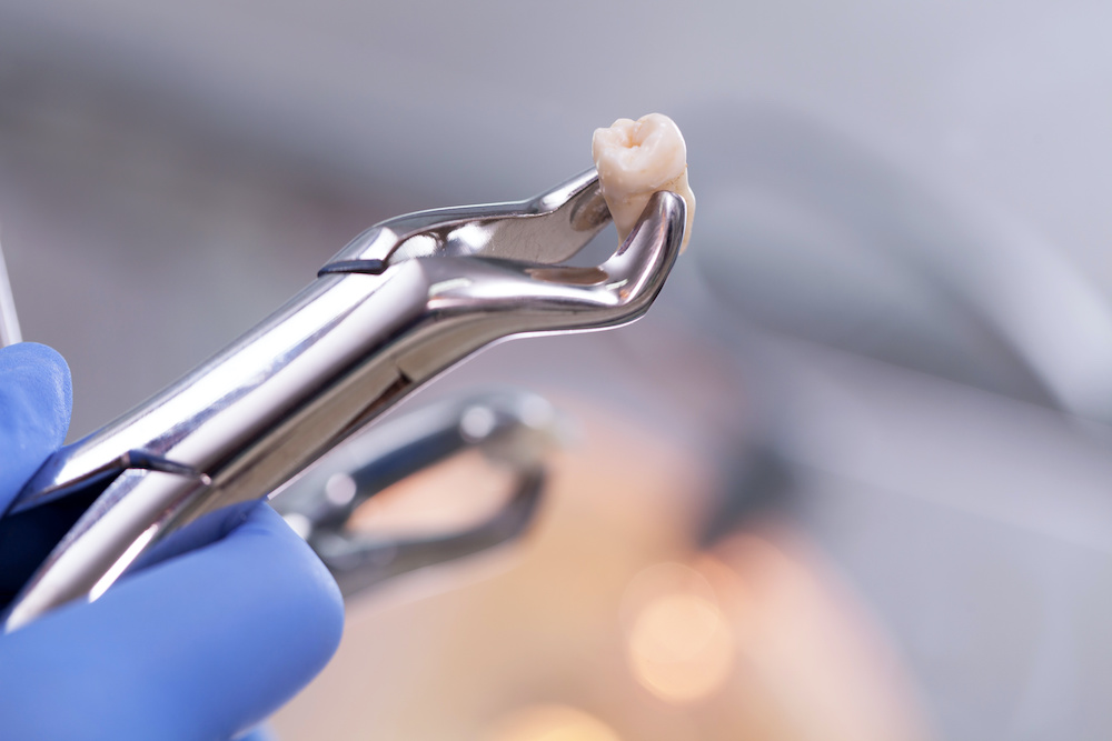 wisdom tooth